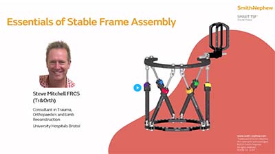 Stable Frame Basics