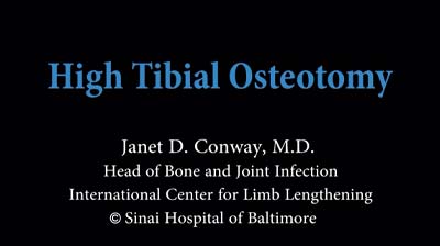 High Tibial Osteotomy